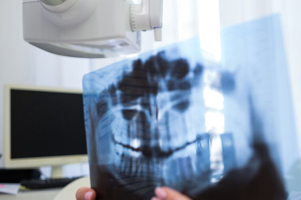 Zdjęcie cefalometryczne (cefalometria zębów): czym jest, cena | Baltic Ortho Clinic