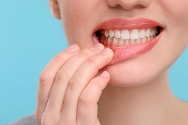 Zapalenie jamy ustnej: przyczyny, objawy, leczenie | Baltic Ortho Clinic